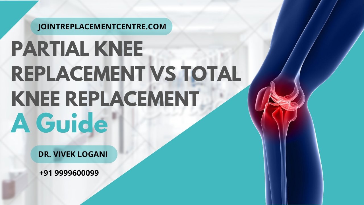 Partial Knee Replacement vs Total Knee Replacement – A Guide